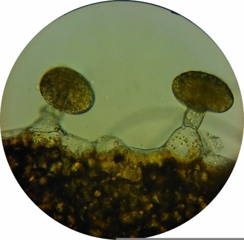 Microscopisch beeld van schimmeldraden met twee sporendoosjes erboven, op een bruine achtergrond.