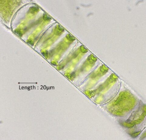 Microscopische opname van groene algenketen; lengte 20 µm aangegeven.