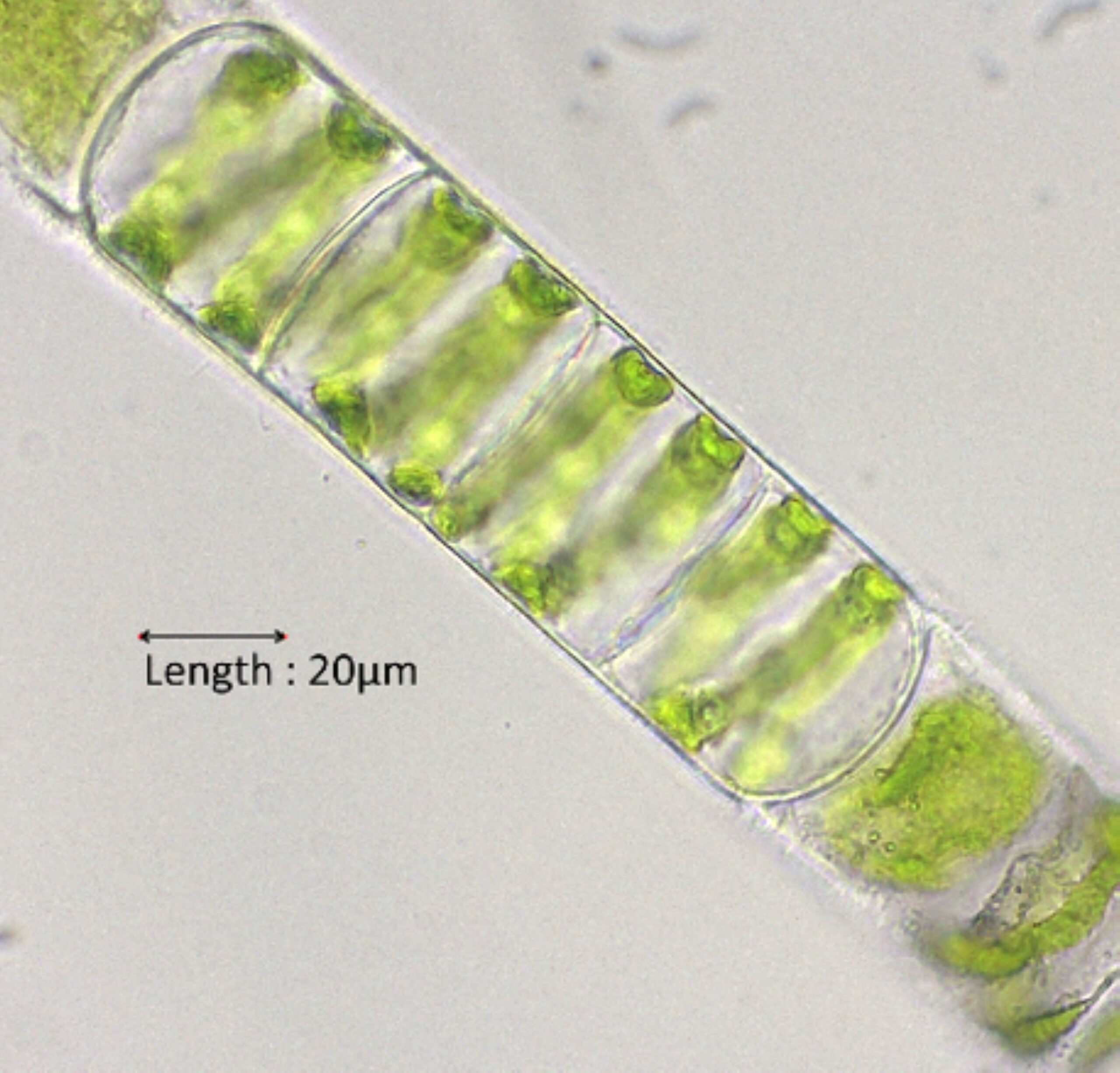 Microscopische opname van groene algenketen; lengte 20 µm aangegeven.