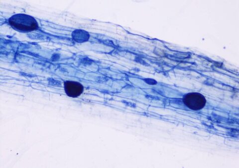Microscopische opname van blauwgekleurde schimmelsporen en hyfen op een witte achtergrond.